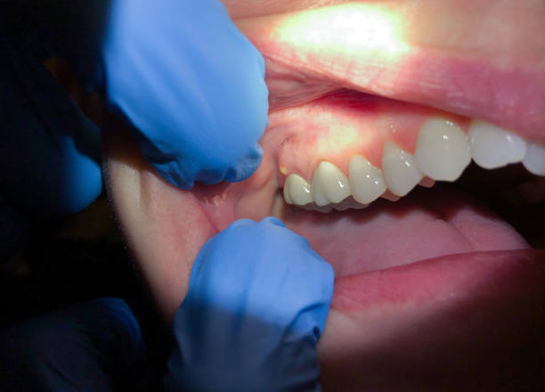 Best Emergency Gum Pain Relief  in White Horse, NJ